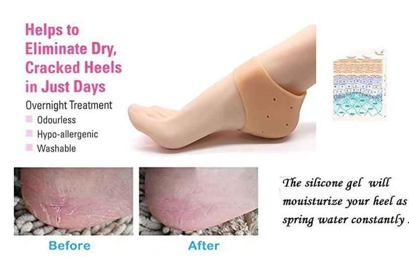 Anti-Crack Silicone Gel Heel Pad